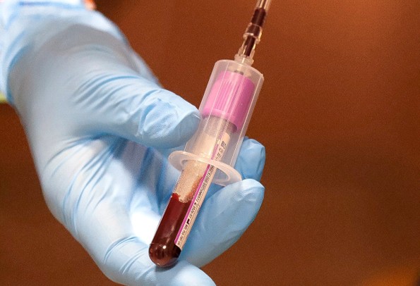 Advanced Blood Analysis - Tomorrow Wellness